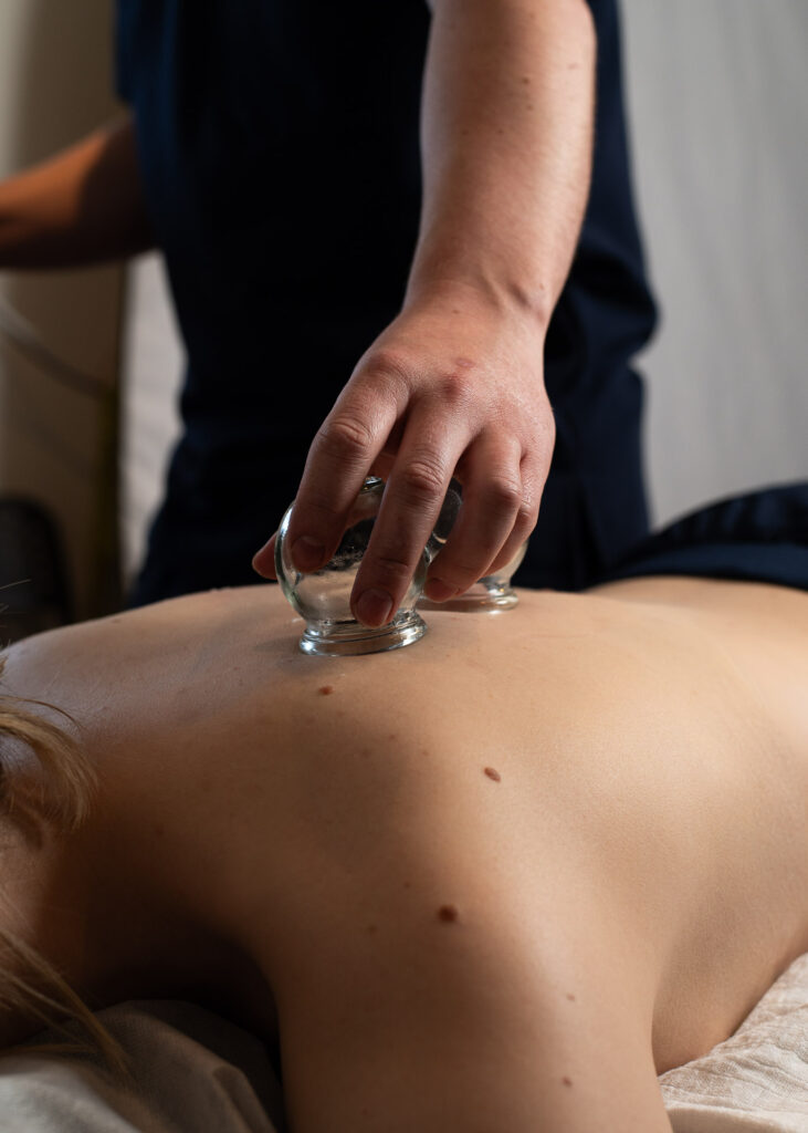 Dłoń terapeuty pracuje z bańką na plecach pacjentki.